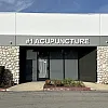 #1 acupuncture photo